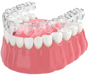 Лечение на элайнерах (FlexiLigner, 3D Smile)